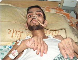 Rights org: Gaza situation potentially disastrous 