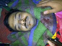 Interior Ministry Militias Murder Freedom and Justice Young Leader After Arrest