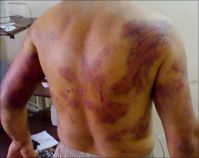 Palestinian prisoner in Egyptian jail in serious health condition